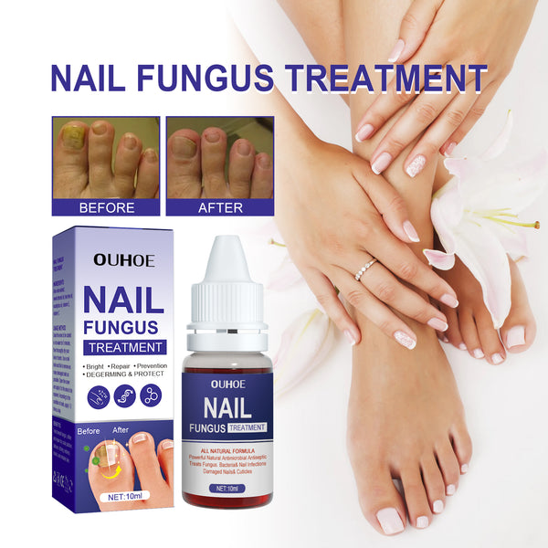 OUHOE Nail Repair Lotion, Repair Thickening Nail Inlay Gray Nail Shine Soft Nail Care Solution